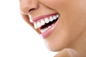 Kaplama Diş Hakkında Sıkça Sorulan Sorular